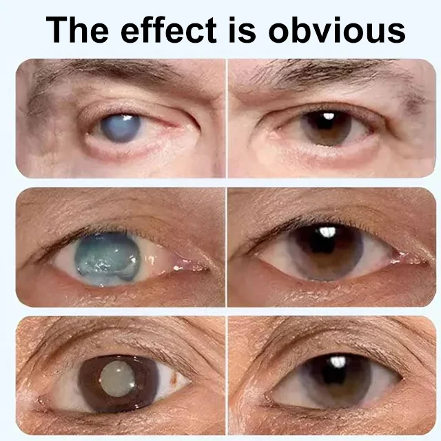 Blueberry Eye Dryness Treatment Liquid