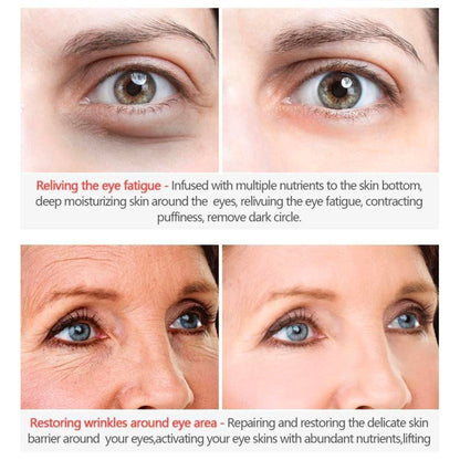 CHRISTMAS SALE- ELLEN ELLA Advanced Eye Cream-Remove Dark Circles, Eye Bags, Wrinkles-Make you 20 years younger