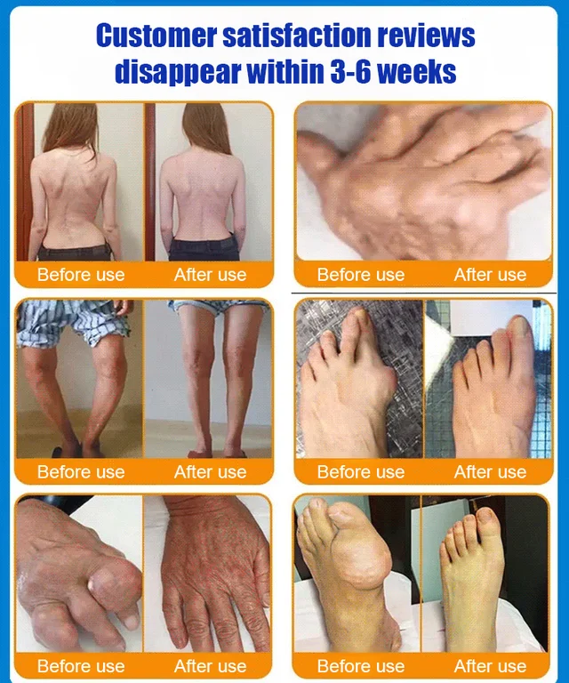 All-body joint relief gel