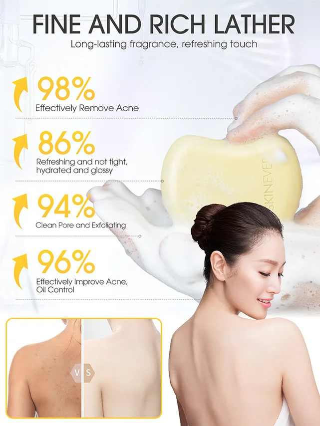 [Washes away 99.9% of dust mites] Salicylic acid soap