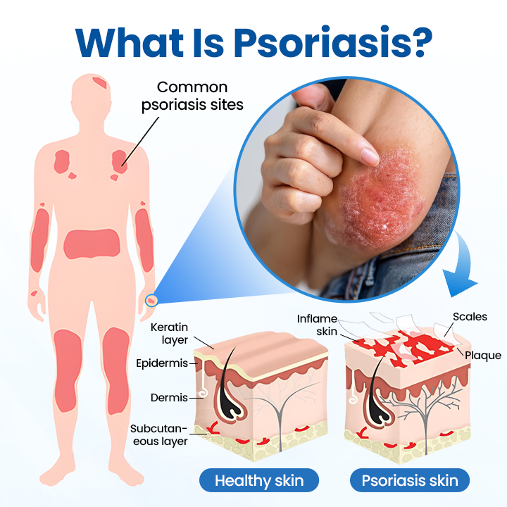 Zvoevo® PCA Magnesium Deep Repair Spray