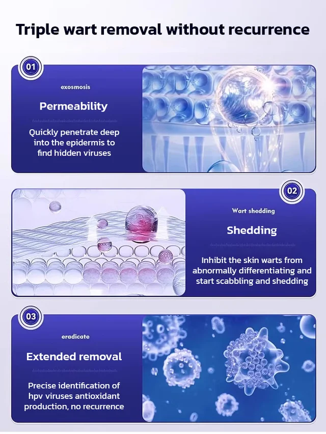 Herbal wart and corn removal cream