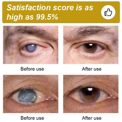 Honey Eye Care Solution