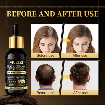 [Strong Hair Growth] Bio-Nourish Hair Essence