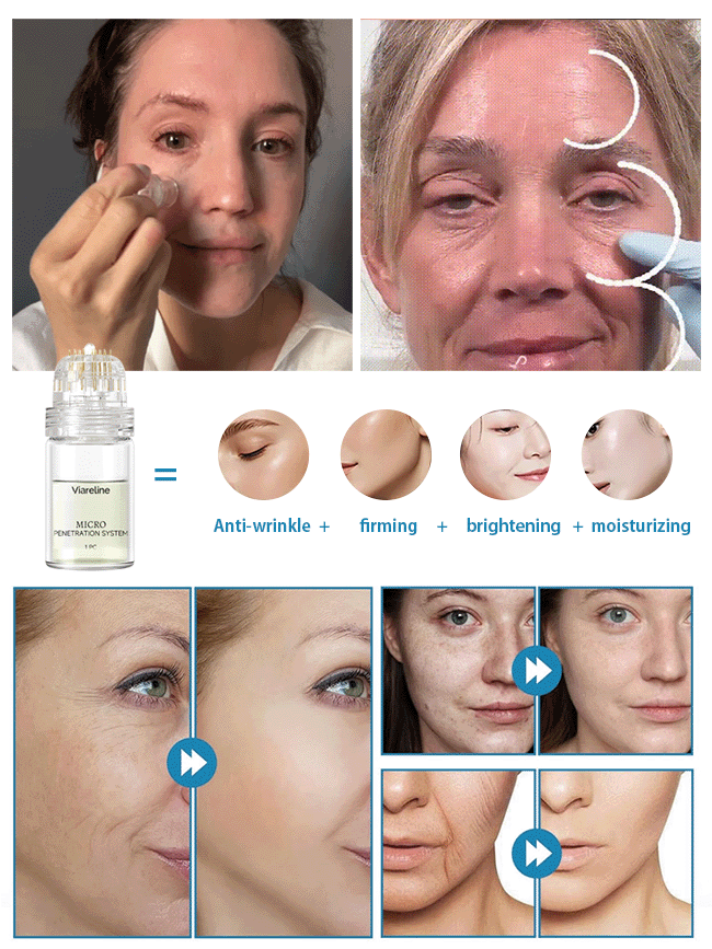 ANTI-WRINKLE MICRONEEDLE SERUM SET