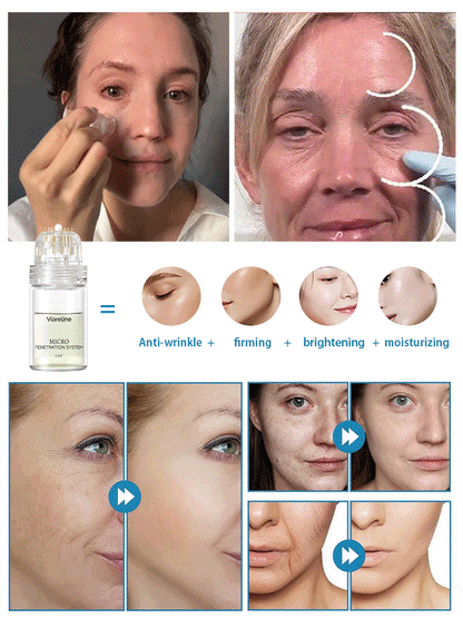 ANTI-WRINKLE MICRONEEDLE SERUM SET