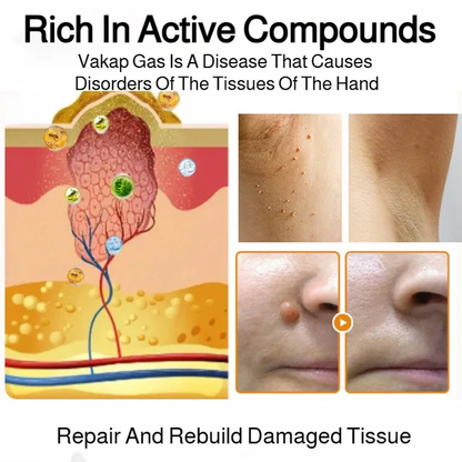 Patch Wart Flesh Mole Acne Patch Beauty Skin Care No Pain Easy To Operate