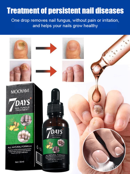Ginger Nail Care Solution