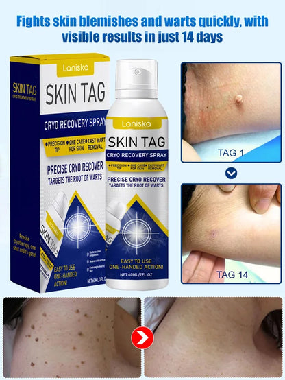 LANISKA Wart Care Topical Spray🌟