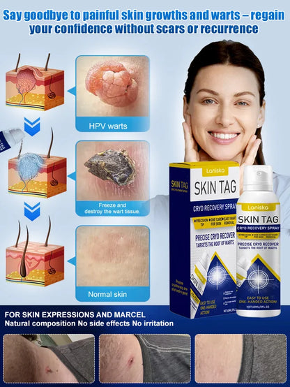 LANISKA Wart Care Topical Spray🌟