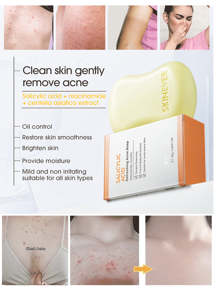 [Washes away 99.9% of dust mites] Salicylic acid soap