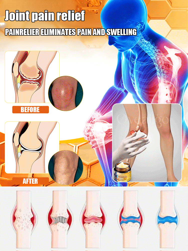 Bee Venom Joint Repair Cream