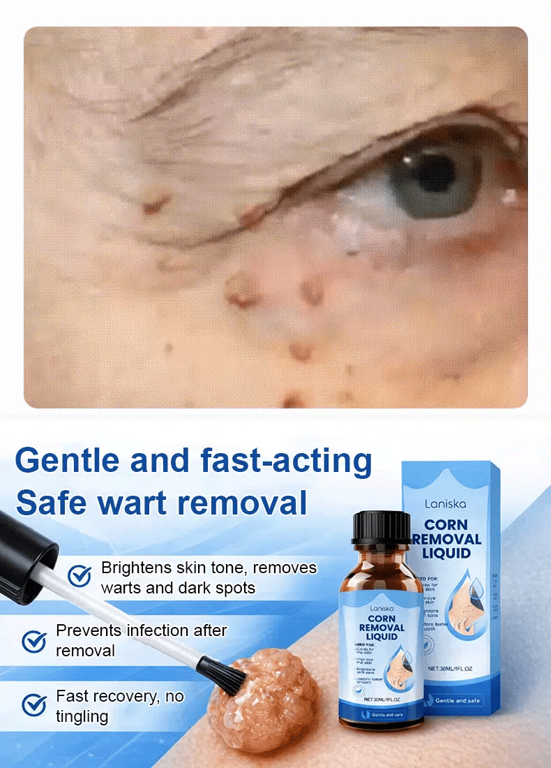 Mole and wart removal care solution
