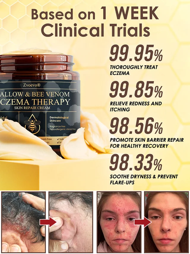 Bee Venom Skin Care Cream