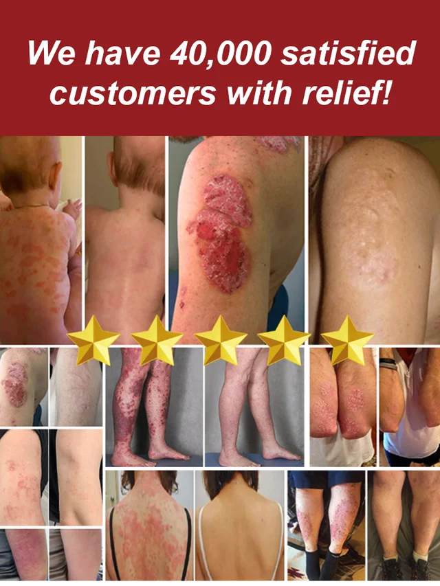 Skin Care Gentle Spray-✨Unlock radiant, healthy skin—🌿just one spritz away from a natural glow!