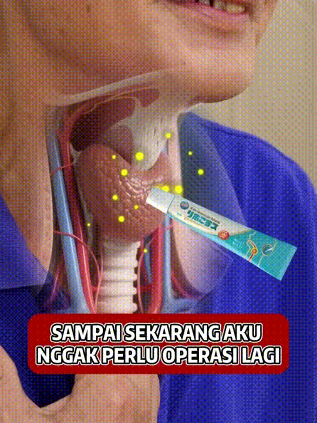 Acute and chronic pharyngeal flatulence gel