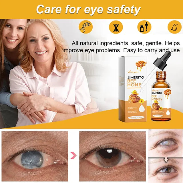 Honey Eye Care Solution