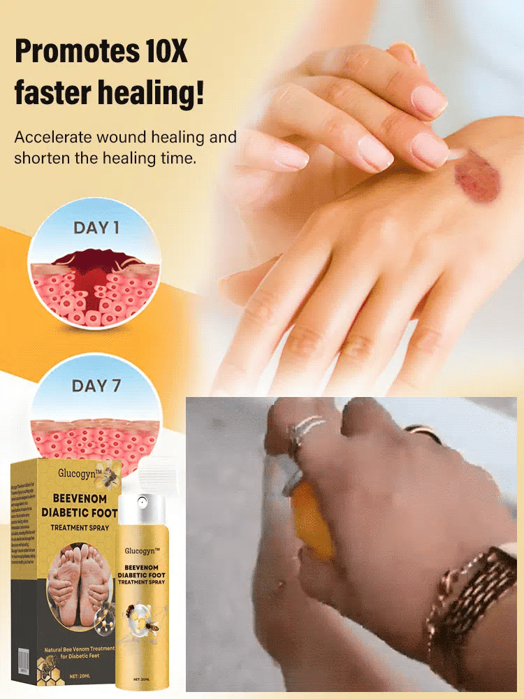 Diabetic foot treatment spray