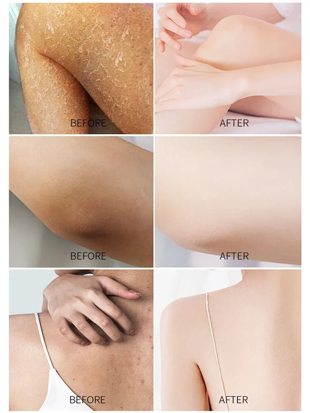 Niacinamide Whitening Soap