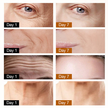 CHRISTMAS SALE- ELLEN ELLA Advanced Eye Cream-Remove Dark Circles, Eye Bags, Wrinkles-Make you 20 years younger