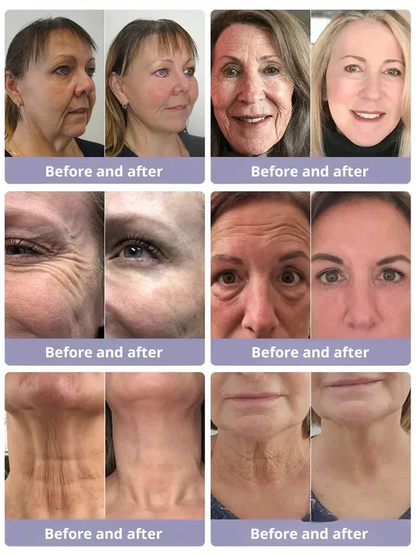 ANTI-WRINKLE MICRONEEDLE SERUM SET