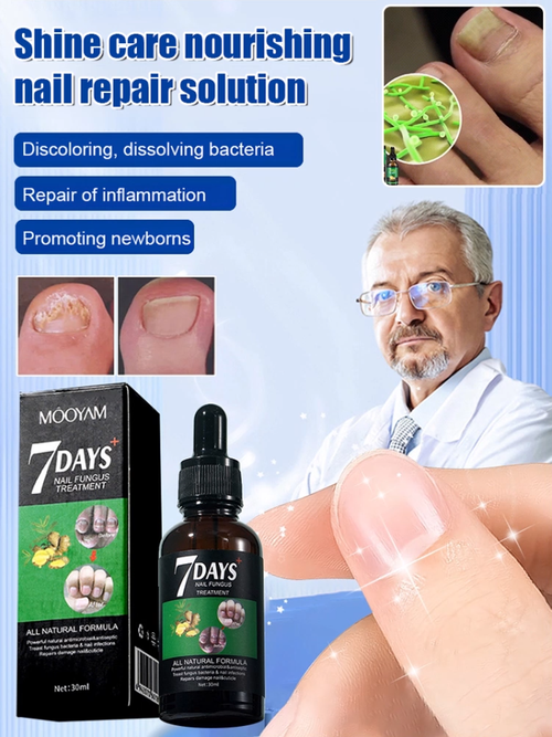 Ginger Nail Care Solution