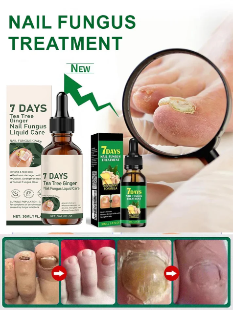 [Nail Care Solution]Professional Nail Repair Solution – Strengthen & Restore Nails