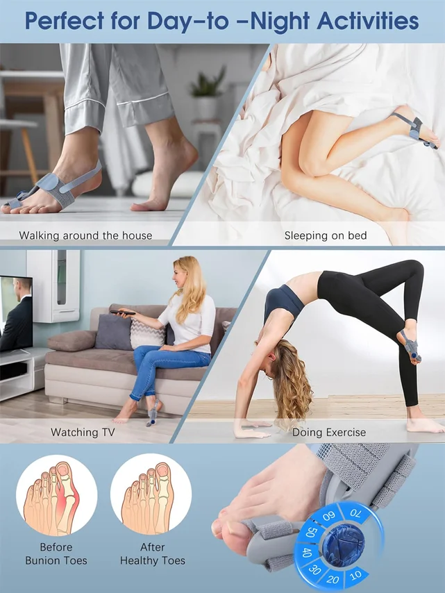 [No surgery required] Hallux valgus corrector