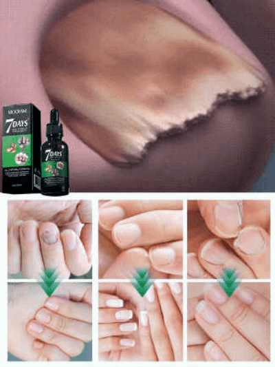 Ginger Nail Care Solution