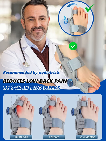 [No surgery required] Hallux valgus corrector