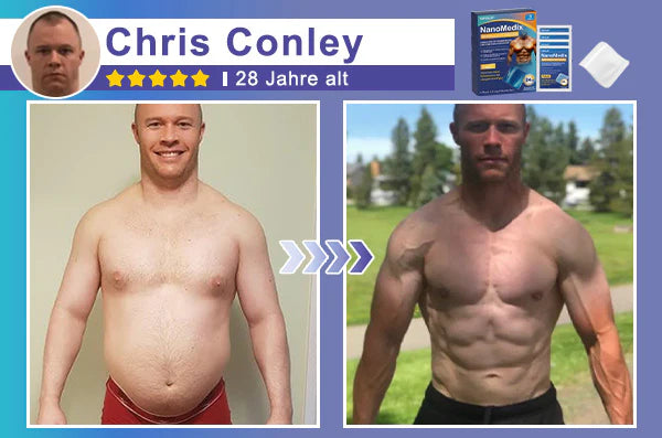 🔥STARTYNX®NanoMedix™ Gynecomastia Breast Fat Burning & Firming Patch