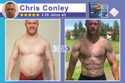 🔥STARTYNX®NanoMedix™ Gynecomastia Breast Fat Burning & Firming Patch