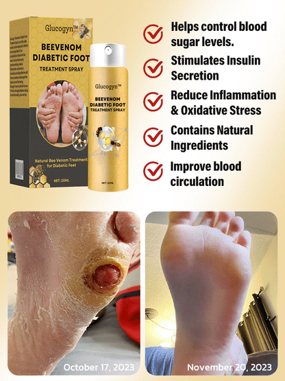 Diabetic foot treatment spray