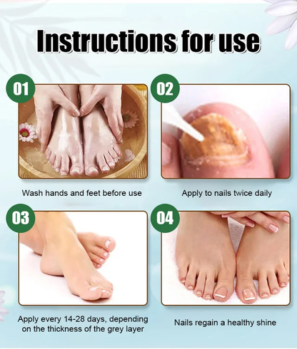 Ginger Nail Care Solution